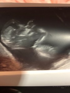 58364259946__91c6c62b-41fa-4649-9f4e-7a4010900778